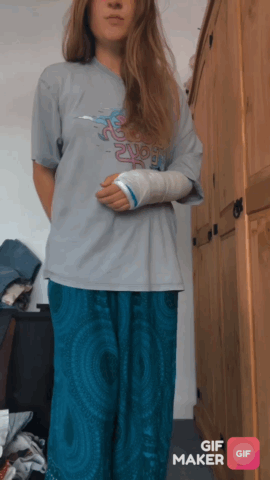 Even Though I Have A Cast At The Moment Am